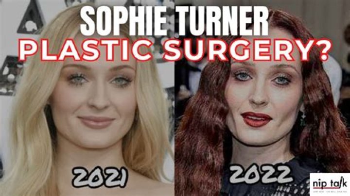 Did Sophie Rain Get Any Plastic Surgery? Unveiling the Truth Behind Her Transformation