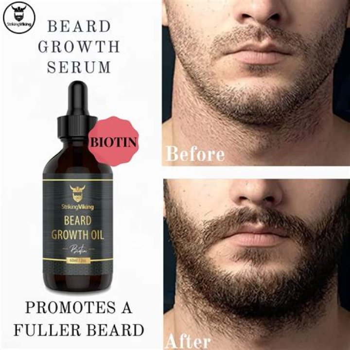 Does Beard Oil Help Beard Growth: Unlocking the Secrets of a Lush Beard