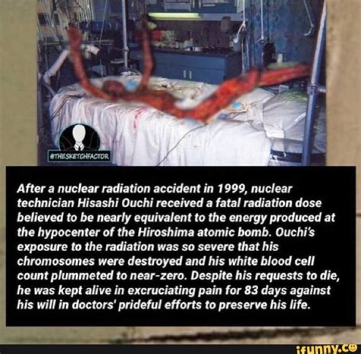 Hisashi Ouchi: The Heartbreaking Story Behind the Real Photos from the Hospital