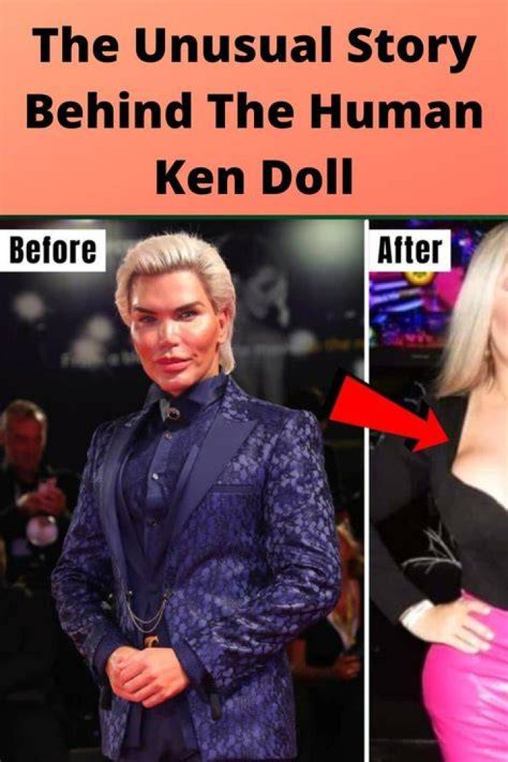 Human Ken Doll: The Extraordinary Journey of Rodrigo Alves