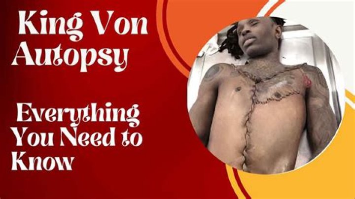 King Von Autopsy Photo: Understanding the Controversy and Its Impact on Fans