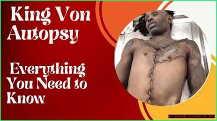 King Von Autopsy Results: Unraveling the Truth Behind the Late Rapper's Death