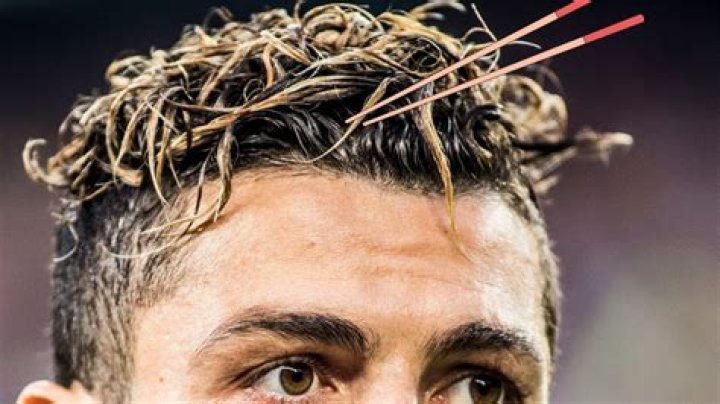 Ronaldo Noodle Hair: The Iconic Style That Made Waves Around the World