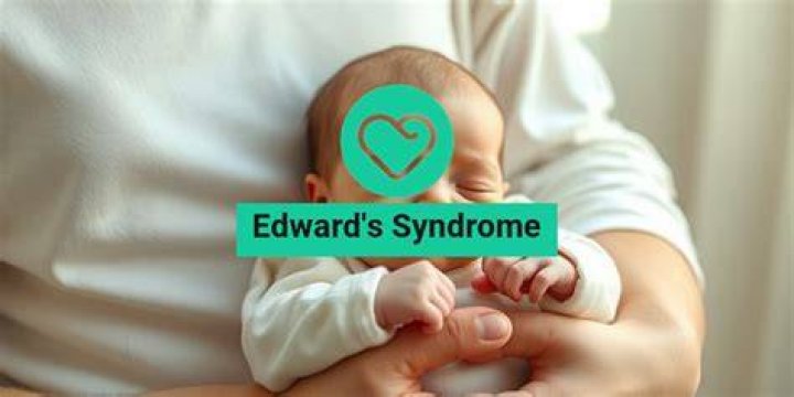 Understanding Edward Bluemel Syndrome: Symptoms, Causes, and Management