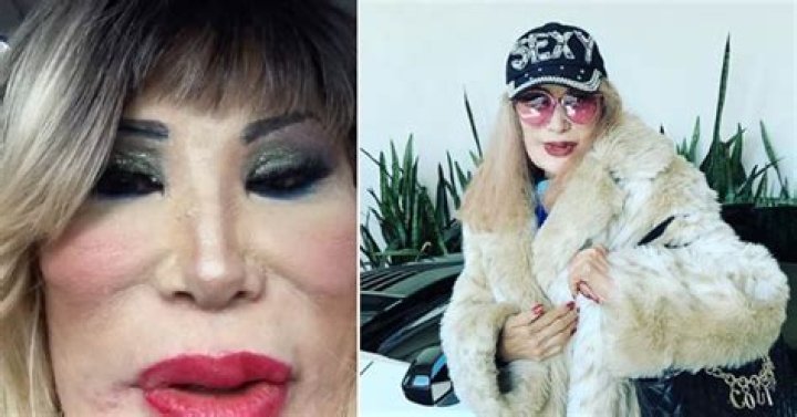 What Happened to Lyn May's Face? A Comprehensive Investigation